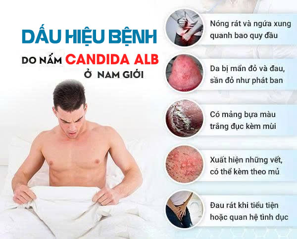 Tổng Quan Nấm Sinh Dục Nam