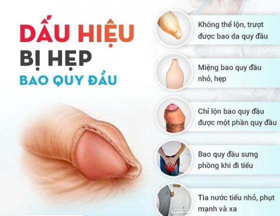 Dấu Hiệu Nhận Biết Hẹp Bao Quy Đầu Ở Nam Giới
