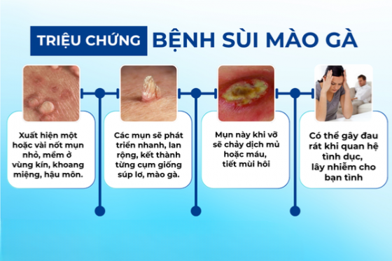 Sùi Mào Gà Ở Nam Giới: Bệnh Lý Không Thể Xem Thường