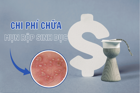 Chi Phí Chữa Mụn Rộp Sinh Dục Bao Nhiêu?