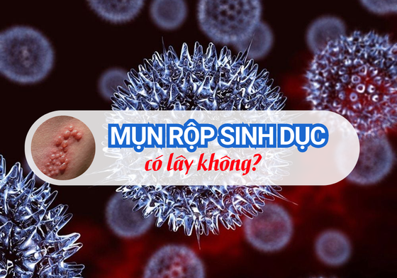 Mụn Rộp Sinh Dục Có Lây Không?