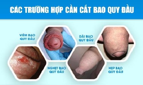 cat-bao-quy-dau(6).jpg