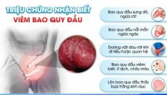 Điều Trị Viêm Bao Quy Đầu Ở Đâu An Toàn Hiệu Quả Tại Bình Dương