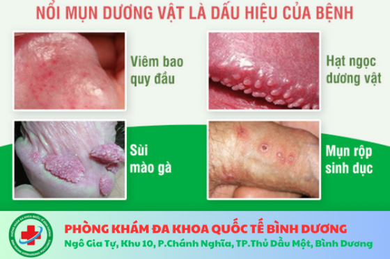 Phòng khám Đa Khoa Quốc Tế BÌNH DƯƠNG Ngô Gia Tự, Khu 10, P.Chánh Nghĩa, TP.Thủ Dầu Một, Bình Dương (4).png