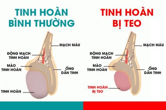 teo-tinh-hoan.jpg