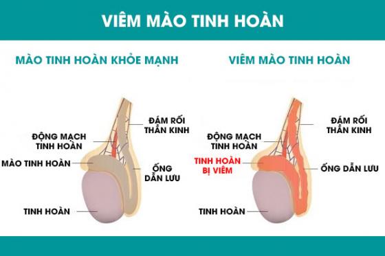 viem-mao-tinh-hoan.jpg