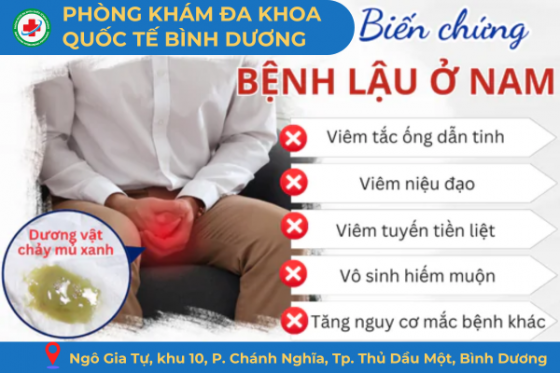 bien-trung-lau.png