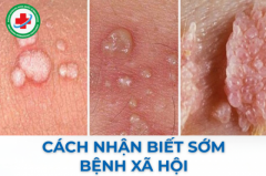 Các phương pháp chữa bệnh xã hội hiệu quả