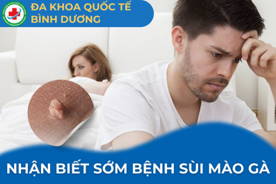 Sùi Mào Gà Giai Đoạn Đầu Ra Sao?