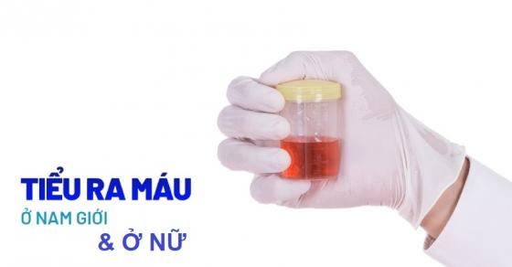 tieu-ra-mau-o-nam.jpg