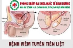 Dấu hiệu nhận biết viêm tuyến tiền liệt? Cách điều trị hiệu quả tại bình 