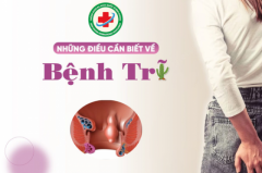 Những Điều Cần Lưu Ý Về Bệnh Trĩ 