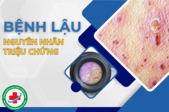 Nhận biết dấu hiệu mắc bệnh lậu, Cần làm gì khi phát hiện?