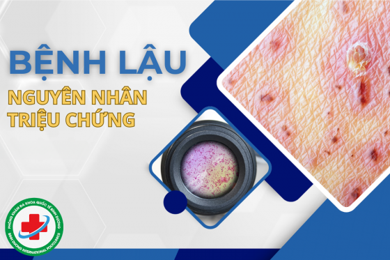 BENHLAU.png