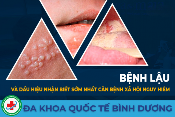 benh-lau.png