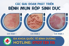 Tổng Quan Về Mụn Rộp Sinh Dục: Nguyên Nhân Và Cách Điều Trị Hiệu Quả