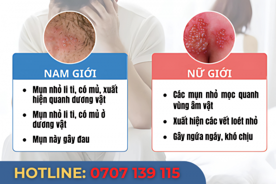 DẤU-HIỆU-MR.png