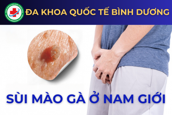 Sùi mào gà ở nam giới: Bệnh lý không thể xem thường