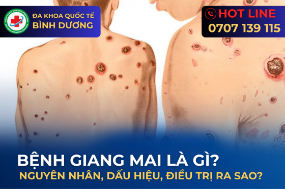 Giang Mai Là Gì? Dấu Hiệu Nhận Biết, Nguyên Nhân và Cách Điều Trị Hiệu Quả