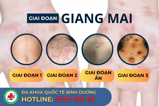 gd-giang-mai.png