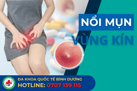 Nổi Mụn Âm Đạo Là Triệu Chứng Bệnh Gì? Tìm Hiểu Ngay
