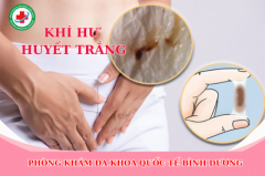 Tìm Hiểu Về Huyết Trắng Thường Gặp Phải Ở Chị Em