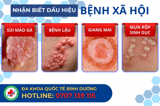 bxh (10).png