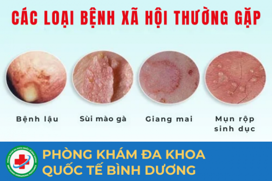 cac-benh-xa-hoi.png