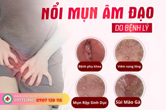 mun am dao.png