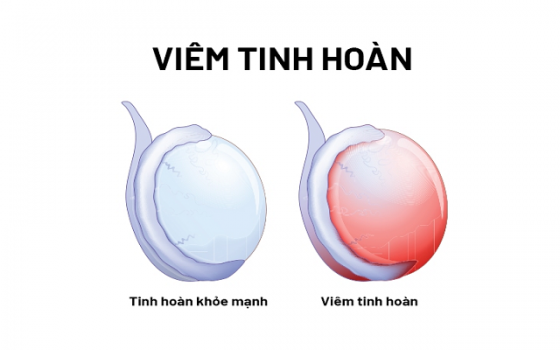 image.psd-21.png