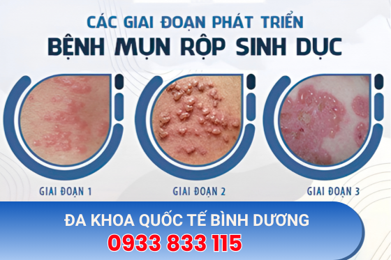 benh-xa-hoi (12).png
