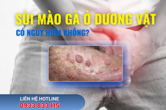 benh-xa-hoI-1.png