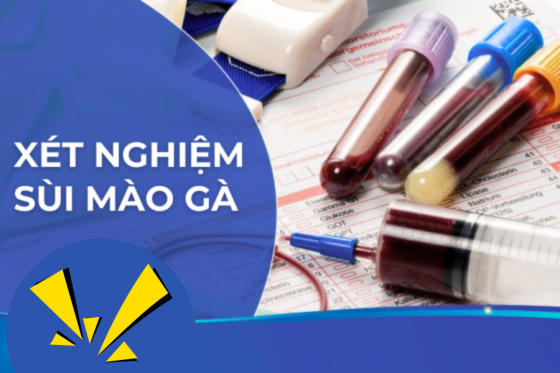 Xét Nghiệm Sùi Mào Gà: Khi Nào Cần Làm và Ở Đâu Đáng Tin Cậy?