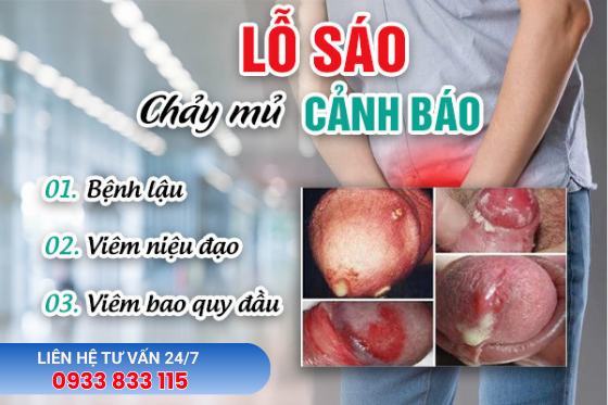 Dương Vật Chảy Mủ Xanh Do Đâu? Có Phải Bệnh Lậu?
