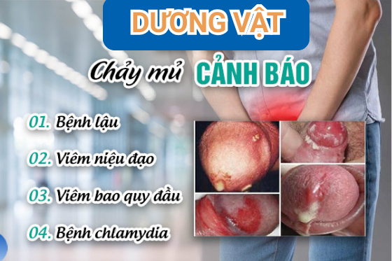 Nguyên Nhân Dương Vật Chảy Mủ Trắng: Cảnh Báo Mắc Bệnh Lý