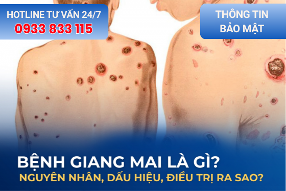 Giang Mai Là Gì? Dấu Hiệu Nhận Biết, Nguyên Nhân và Cách Điều Trị Hiệu Quả
