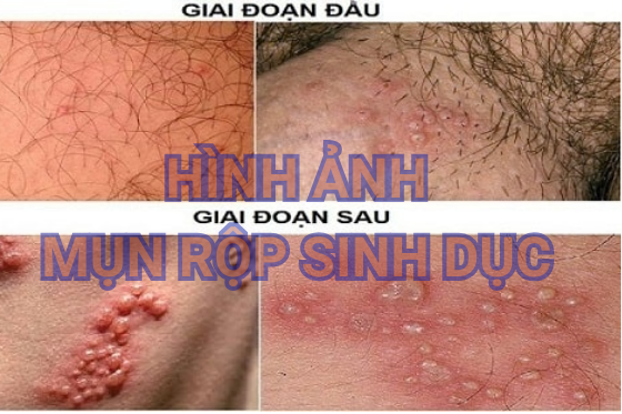 benh-xa-hoi (60).png
