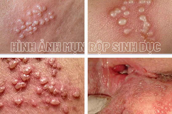 benh-xa-hoi (63).png
