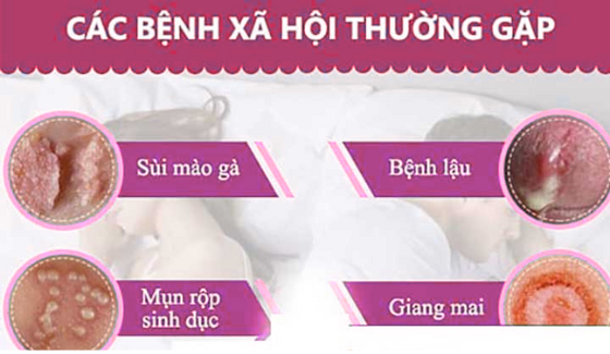 benh-phu-khoa (4).png